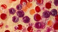 Advanced Blood Microscopy: Detailed Study of Lymphocyte Elements for Medical Diagnoses.