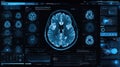 Advanced Brain Scan Visualization Using Technology in a High-Tech Environment With Detailed Analytics and Data Display Royalty Free Stock Photo
