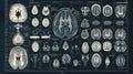 Advanced medical visualization of neural structures in brain scans. concept of neurology, brain health, medical imaging Royalty Free Stock Photo