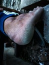 Aesthetic unique shot of stretchmarks on heel sole on dark gradient background