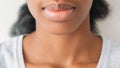 Aesthetics cosmetology lips enhancement woman