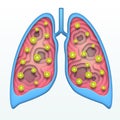 Affected human lungs with covid virus within. Deep paper layered cut out art in origami style. Vector illustration of Coronavirus