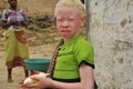 Africa albino child Royalty Free Stock Photo