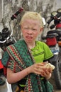 Africa albinos children portrait Royalty Free Stock Photo