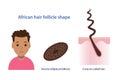 African hair follicle shape vector illustration. Royalty Free Stock Photo