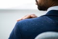 African Man Brushing Dandruff Royalty Free Stock Photo