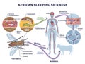 African sleeping sickness or African trypanosomiasis illustration diagram