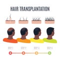 Afro-textured hair transplantation surgery result infographics Royalty Free Stock Photo