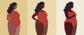 Afro woman plus size, tanning on light skin, flat vector stock illusion as concept of sunburn progress, tan, tanning, summer