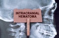 Against the background of an X-ray of the skull, a plate with the inscription - intracranial hematoma