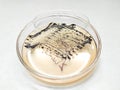 A agar plate of Staphylococcus aureus (foodborne pathogen) with black colonies