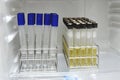 Agar in test tube rack for testing microbiology laboratory