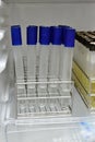 Agar in test tube rack for testing microbiology laboratory