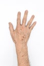 Age spots on hand of Asian elder man. They are brown, gray, or black spots and also called liver spots, senile lentigo, solar