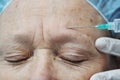 Aged female receiving botox