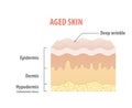 Aged skin diagram illustration vector on white background. Medic