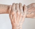 Aging hands of Asian woman. Concept of rheumatoid arthritis , osteoarthritis, wrist strain or joint pain