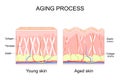 Aging process. comparison of Young and aged skin. Collagen, Elastin and fibroblasts Royalty Free Stock Photo