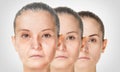 Aging process, rejuvenation anti-aging skin procedures Royalty Free Stock Photo