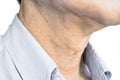 Aging skin folds or skin creases or wrinkles at neck of Asian, Chinese old man