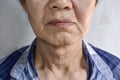 Aging skin folds or skin creases or wrinkles of Asian Chinese old man