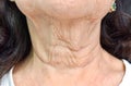 Aging skin folds or skin creases or wrinkles at neck of Asian, Chinese elderly woman