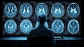 AI Brain Scan Analysis