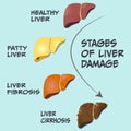 stages of liver damage and disease