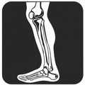 AI generated illustration of a black and white icon of x-ray legs
