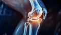 Close-up CT scan of the human knee through the film of the x-ray machine