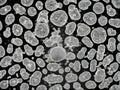 glioblastoma cells concept art black and white electron microscope