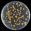 Agar culture of various bacteria in a Petri dish