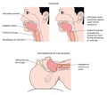 The airway in conscious and unconscious patients