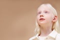 Albino. Cute little girl with albinism syndrome