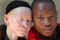 Albino mother and son in Ukerewe, Tanzania Royalty Free Stock Photo