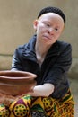 Albino woman in Ukerewe, Tanzania