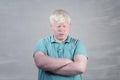 Albino young man portrait. Blond guy isolated at grey background. Albinism