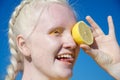 An albino young woman in a yellow blouse against a blue sky. holding slices of sliced lemon.