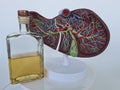 Alcoholic liver damage and liver cirrhosis concept with liver and alcohol