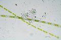 Algae under a microscope.