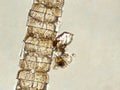 Algae with zooplankton under microscopic view Royalty Free Stock Photo