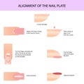 Alignment of the nail plate. Professional manicure guide, Vector illustration, infographics