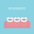 Alignment of teeth with braces. Poster with teeth in braces. Simple white healthy teeth in a row. Orthodontic treatment. Isolated