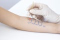 Allergen test on hand. procedure of allergen skin test