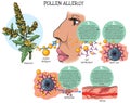 Allergic reaction - immediate type