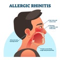 Allergic rhinitis medical diagram, vector illustration labeled information Royalty Free Stock Photo