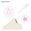 The Allergic Rhinitis Patient with Nose Drops Royalty Free Stock Photo