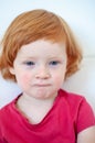 Allergies, atopic dermatitis on the face of a boy Royalty Free Stock Photo