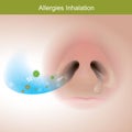 Allergies inhalation. Illustration show close up human nose.