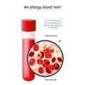 Allergy blood test